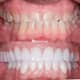 Slider image (6) Dental Project Mexico